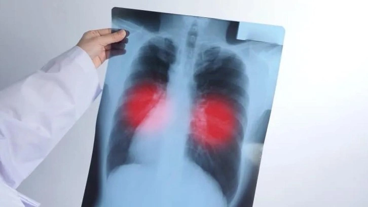 Akciğerinize kalıcı zarar veriyor! Siz de sık sık yaşıyorsanız dikkat