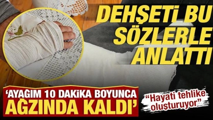 Başıboş sokak köpeğinin saldırısına uğrayan adamın ayağı 2 yerden kırıldı