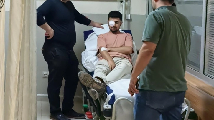 Fabrikada feci kaza: Gözüne çivi saplandı!