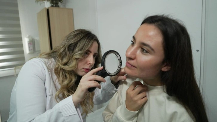 Uzman isim uyardı: Yetişkinler akne sorunuyla karşı karşıya