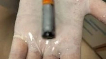 39 yaşındaki hastanın midesinden çıktı! Doktorlar bile şoke oldu