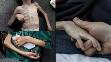 Gazzeli bebeklerin üzerinde ölüm kol geziyor... Son kurban 4 aylık Sekkafi oldu!
