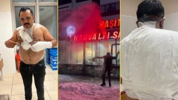 Sivas'ta soğuk hava deneyi hastanede bitti: Meşhur tost&ccedil;u kendini yaktı